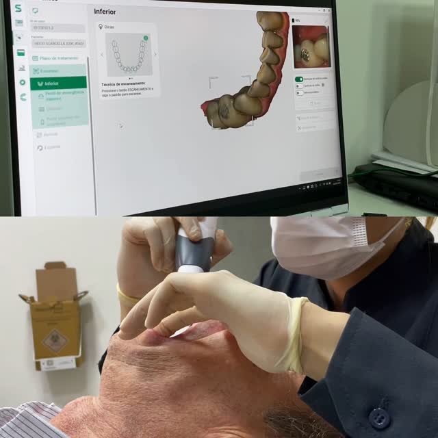 Escaneamento intraoral realizado na Odonto Studio RP